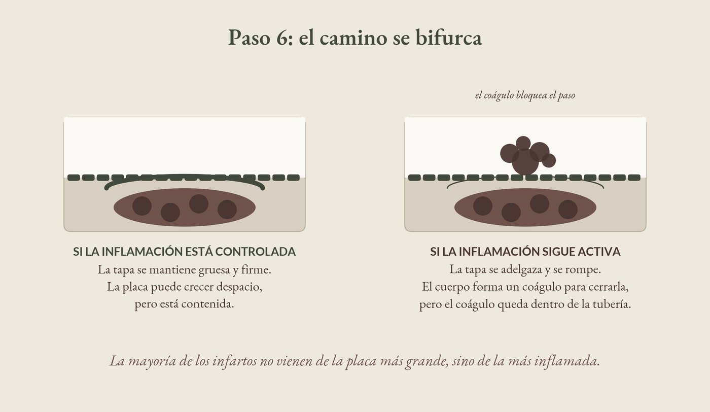 Placa estable y placa inestable